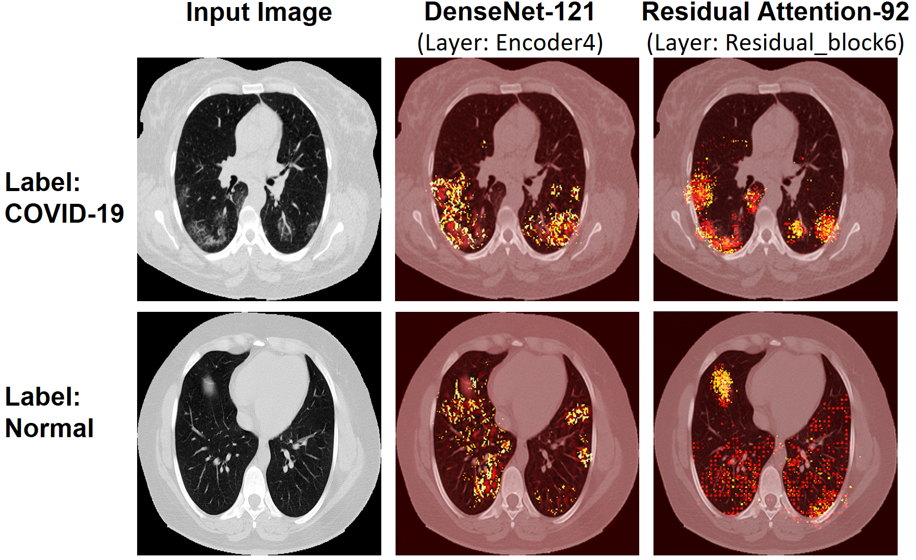 COVID-19 CT Deep Learning Model